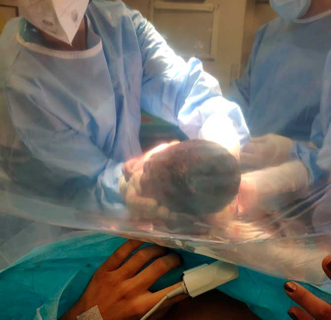 Natural cesarean section