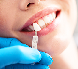Facetas dentárias - HPA Saúde